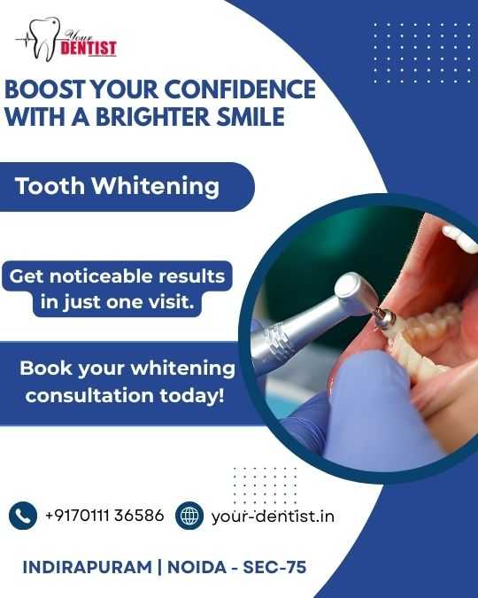 teeth whitening in indirapuram